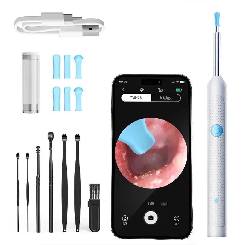 Revolutionary Wireless Wifi Ear Pick with High-Resolution Camera for Effortless Ear Wax Removal and Oral Inspection