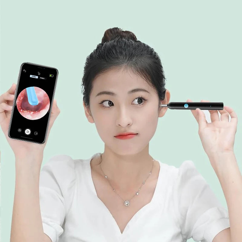 Revolutionary Wireless Wifi Ear Pick with High-Resolution Camera for Effortless Ear Wax Removal and Oral Inspection